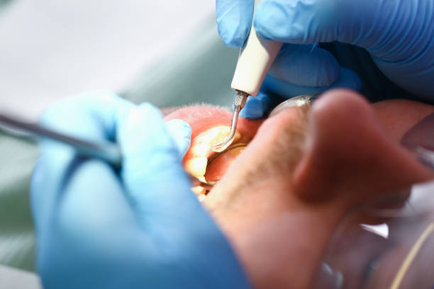Best Broken or Cracked Tooth Emergency Dentist in Elfers, FL