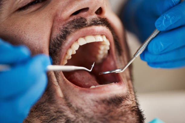 Best Orthodontic Emergency Dentist in Elfers, FL